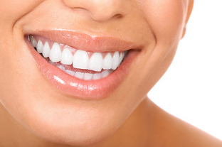 Dentiste Nancy : blanchiment et facettes dentaires (54)